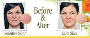 Sensitive Skin Calm