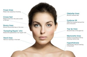 wrinkle reduction treatments