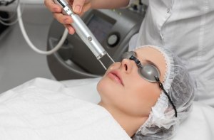 Laser Face Treatment