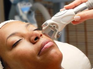 laser-treatment
