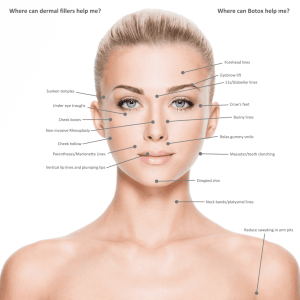 Juvederm Injections Treatment